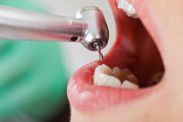 Best Emergency Treatment for Toothache in Daisetta, TX